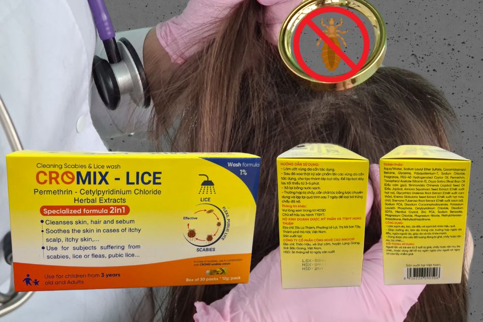 Dầu tắm gói Cromix lice giúp loại bỏ chấy rận nhanh chóng